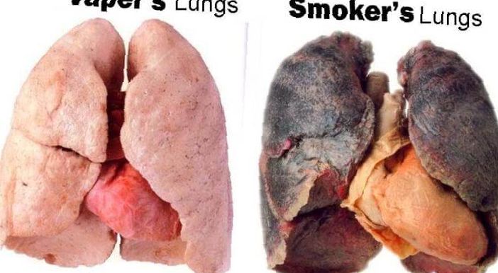 smokers-lungs